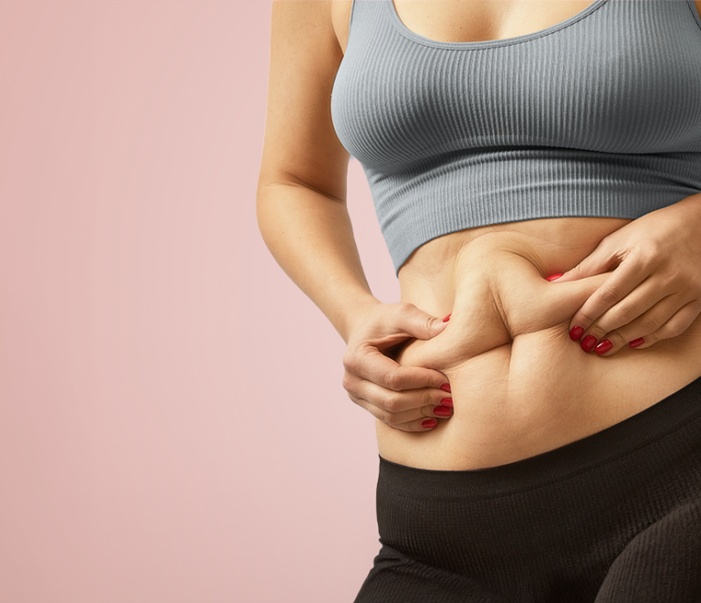 Flacidez na barriga: conheça tratamentos e como firmar a pele