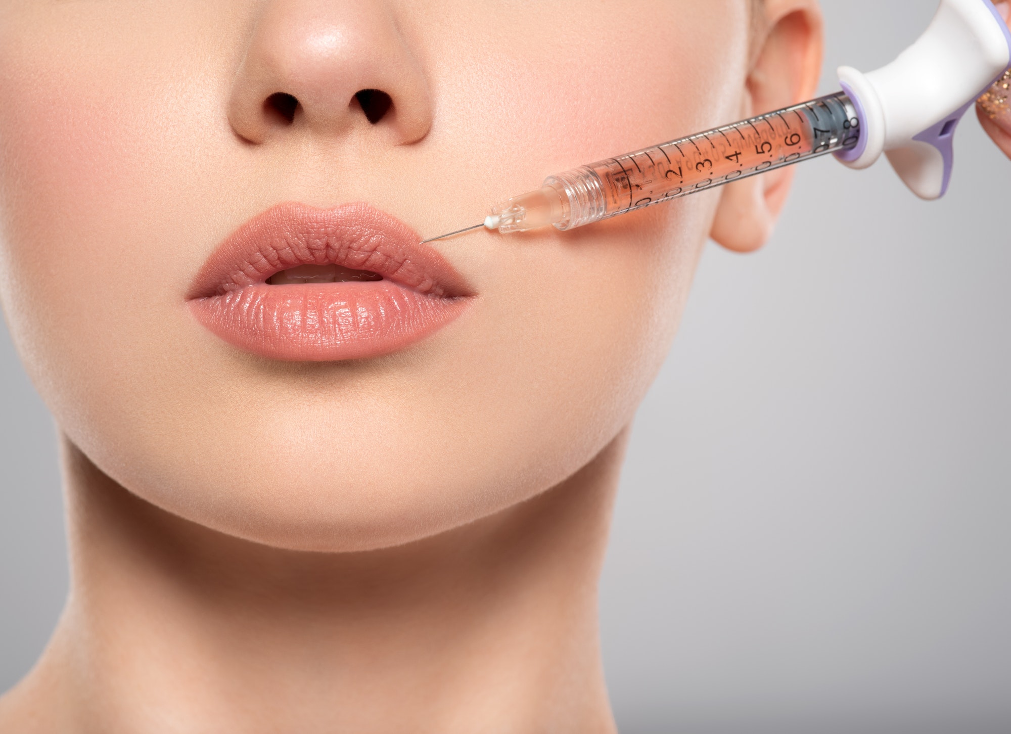 Preenchimento Labial - Aurea Dermatologia Integrada